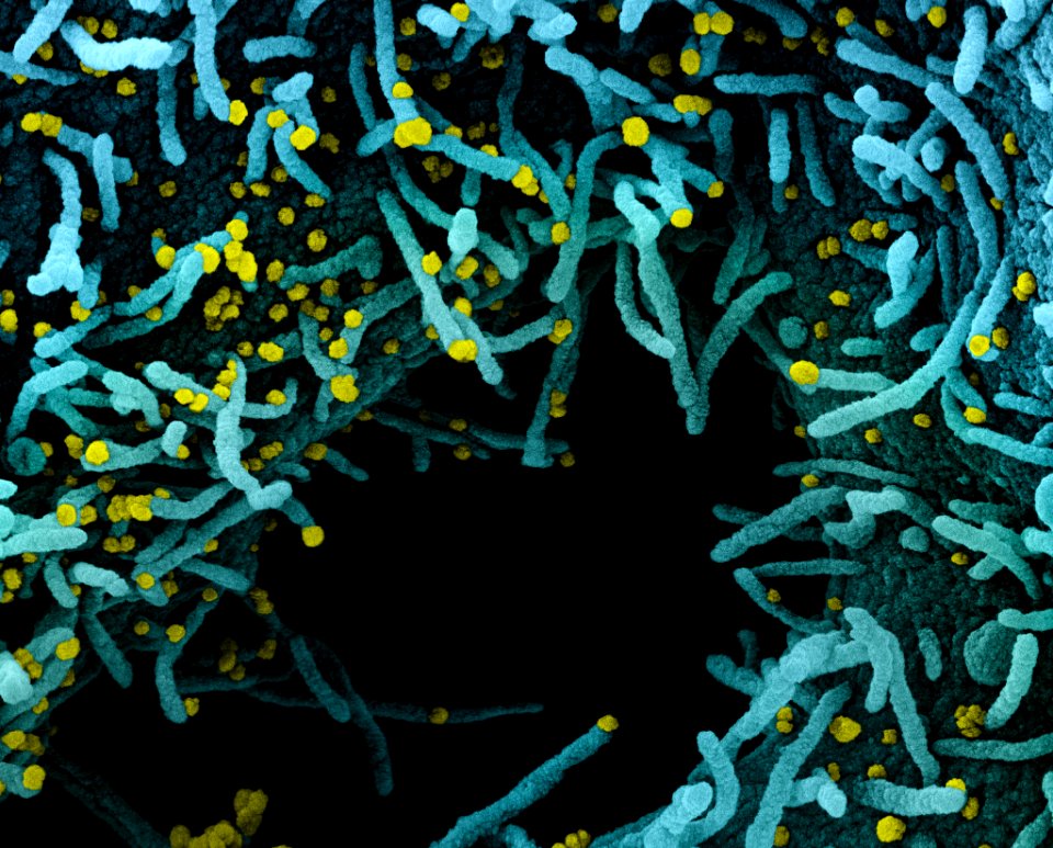 Novel Coronavirus SARS-CoV-2 (50098378522)