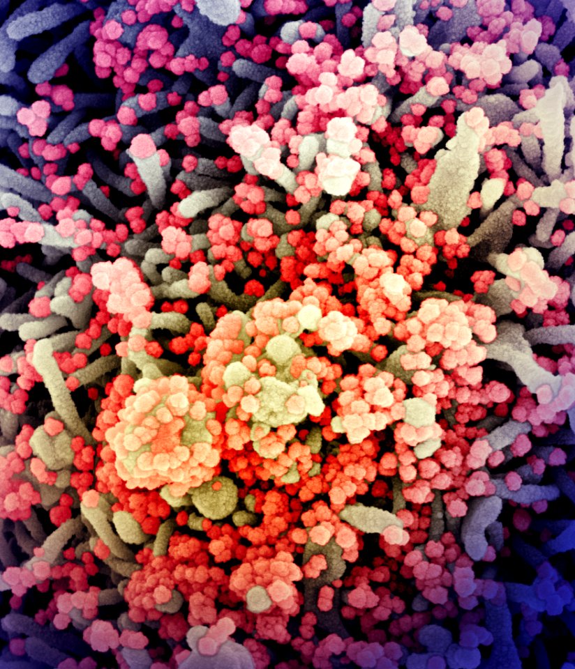 Novel Coronavirus SARS-CoV-2 (50098379552)