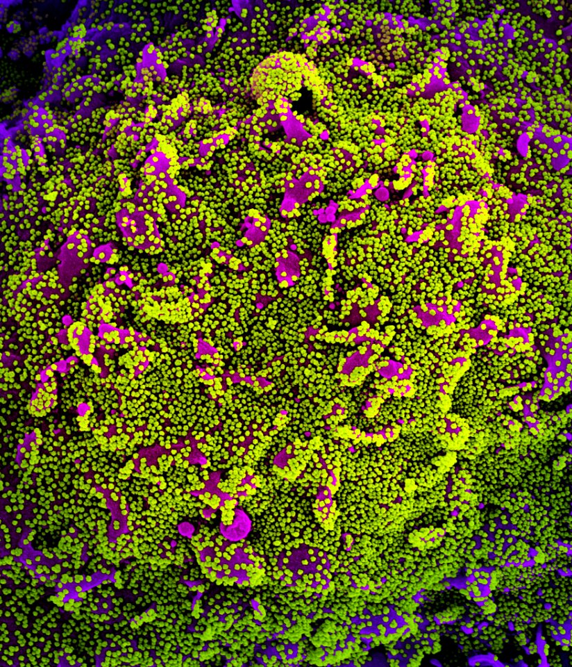 Novel Coronavirus SARS-CoV-2 (50798069831)