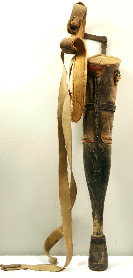 Nožna proteza, 2