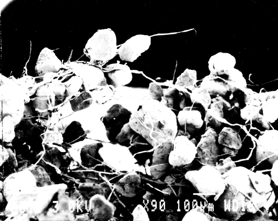 Cyanobacteria wrapped around sand grains (90x magnification) (8590356504)