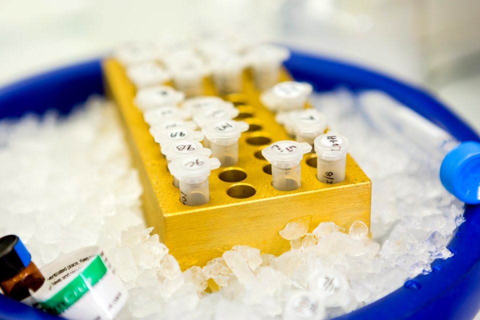 Protein Samples (40099533373)