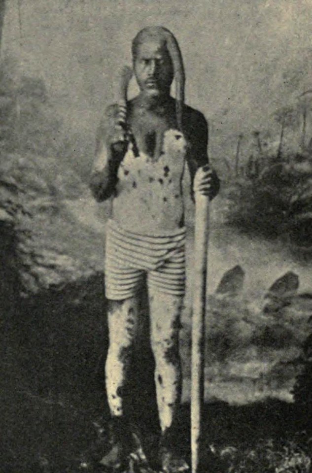 A Loyalty Islander daubed with Lime, Noumea, by Peace , c. 1906