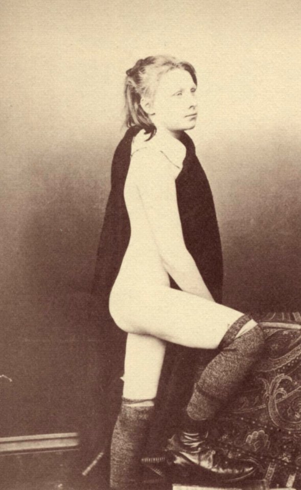 Barnardo, Thomas John - Ein Mädchen mit Lordosis versteckt fast vollständig die Symptome der Krankheit (Zeno Fotografie)