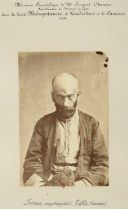 Barry (capitaine). F. 12. Persan scaphocéphale, Tiflis (Caucase). Mission scientifique de Mr Ernest Chantre. 1881