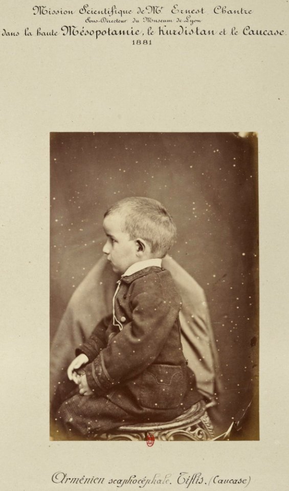 Barry (capitaine). F. 6. Arménien scaphocéphale, Tiflis (Caucase). Mission scientifique de Mr Ernest Chantre. 1881