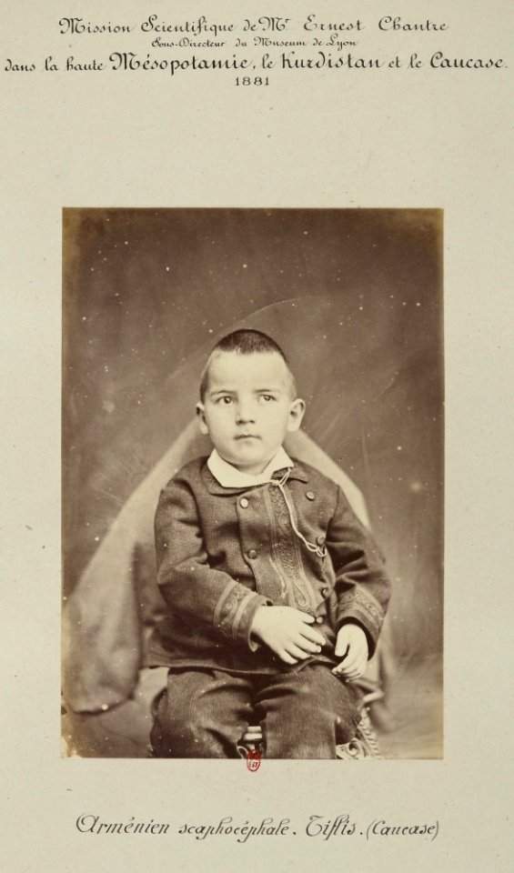 Barry (capitaine). F. 7. Arménien scaphocéphale, Tiflis (Caucase). Mission scientifique de Mr Ernest Chantre. 1881