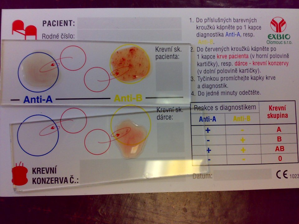 Bloodtype B positive