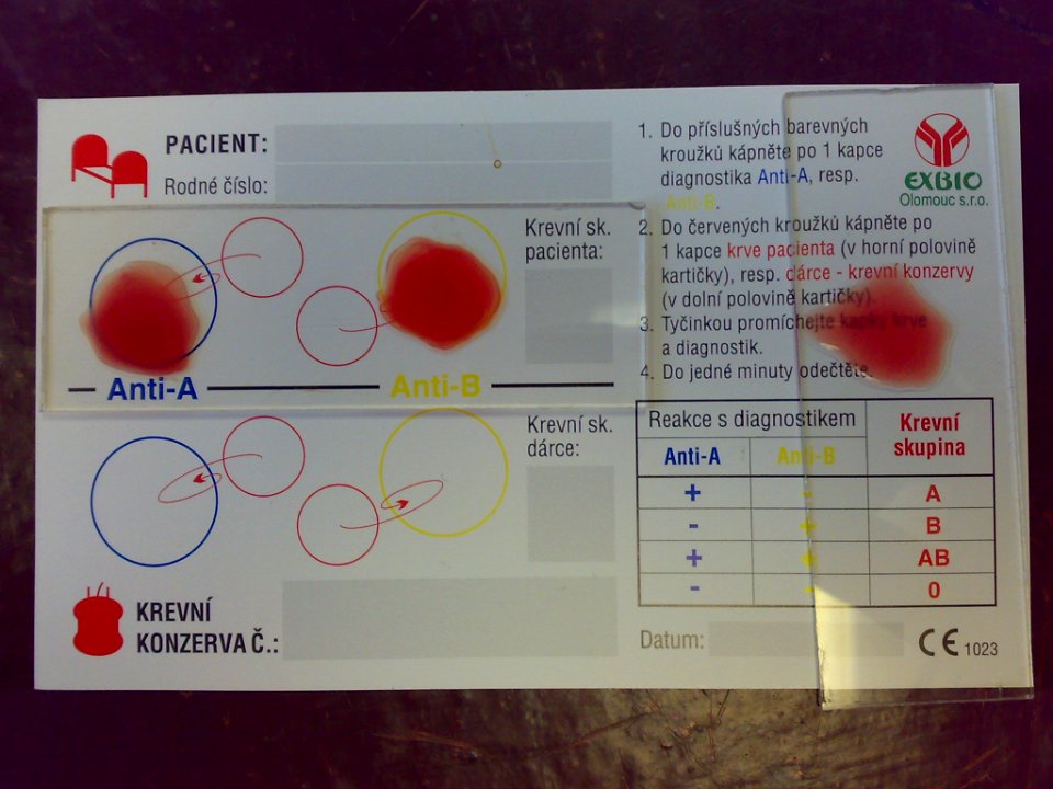 Bloodtype 0 negative
