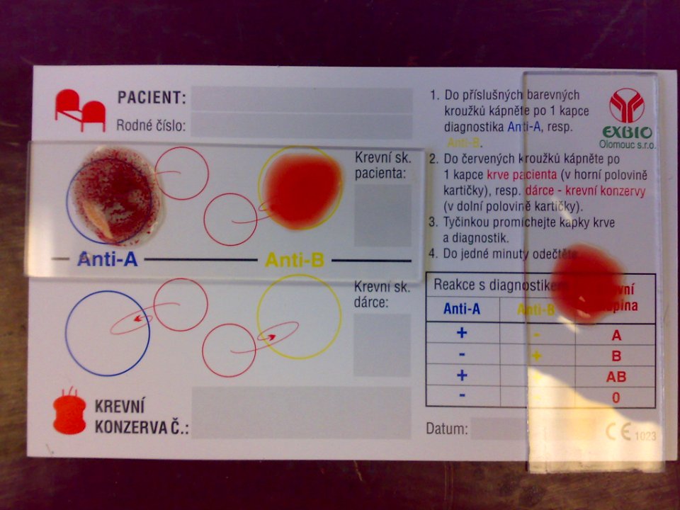 Bloodtype A negative
