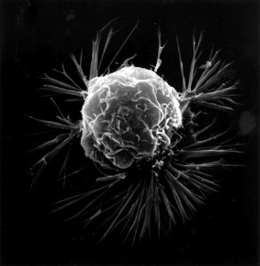 Breast cancer cell (2) photo