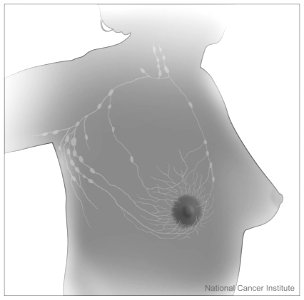 Breast and adjacent lymph nodes (1) photo