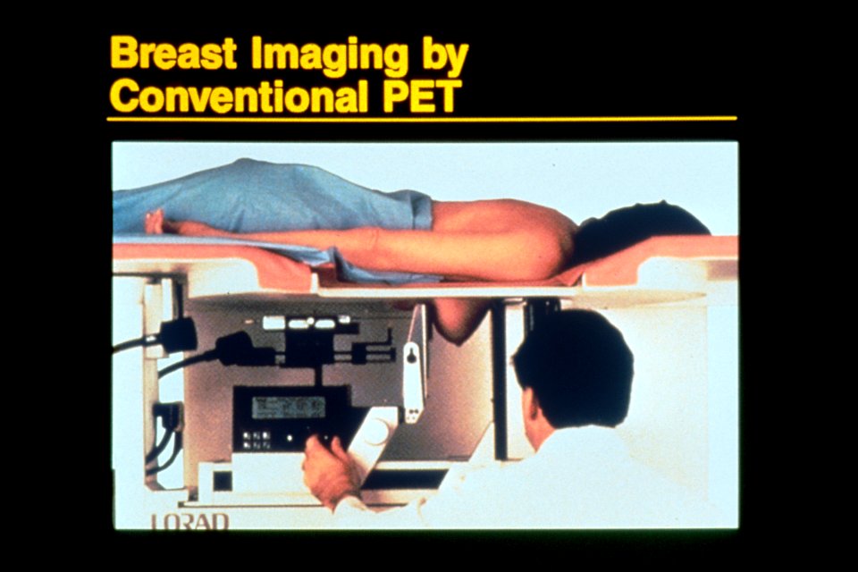 Breast imaging using pet (1)