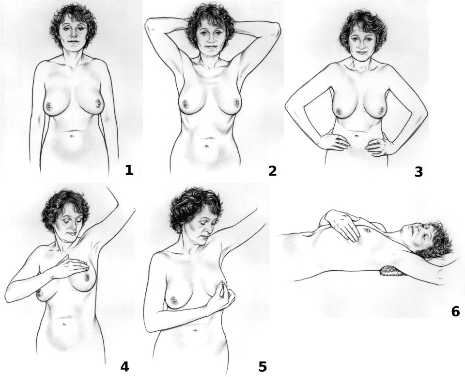 Breast self-exam NCI visuals online photo