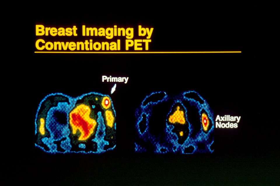 Breast imaging using pet
