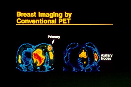 Breast imaging using pet photo