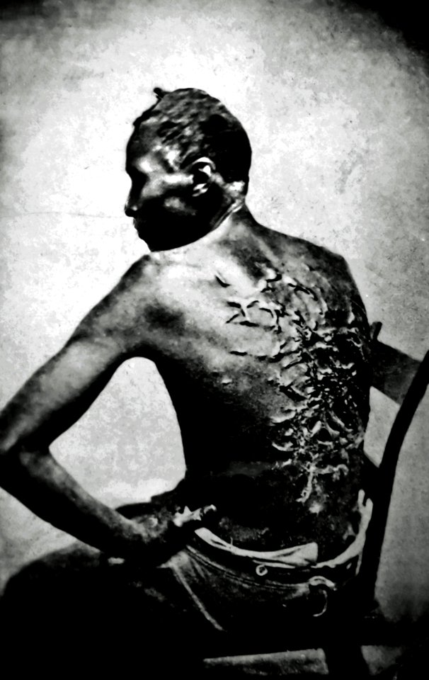 Cicatrices de flagellation sur un esclave retouch2