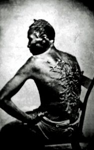 Cicatrices de flagellation sur un esclave retouch2