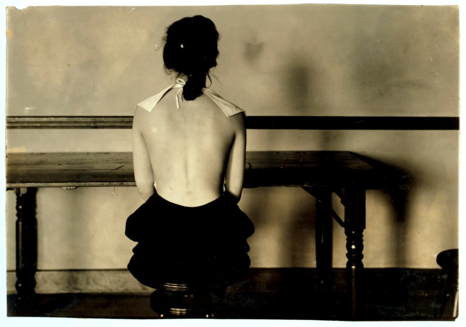 Correct posture for 4663. Need for advice of examining physician. See 4664. LOC nclc.05148