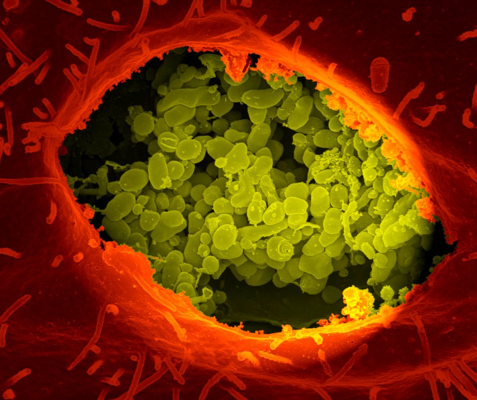 Coxiella burnetii, the bacteria that causes Q Fever