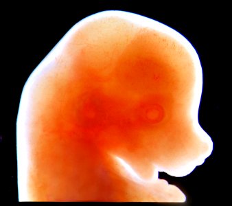 Craniofacial mouse embryo