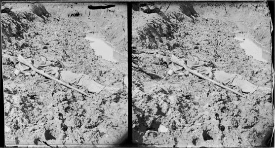 Dead soldier in trench - NARA - 530524