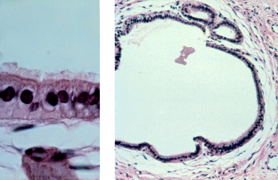 Diethylstilbestrol (des) cervix (27)