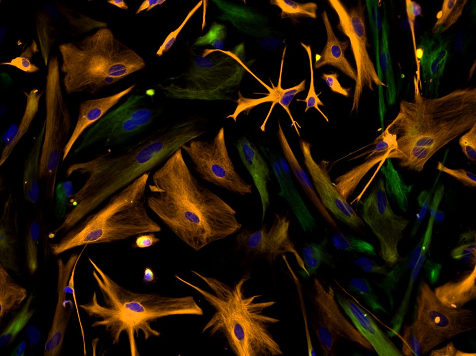 Differentiation Neural Progenitors