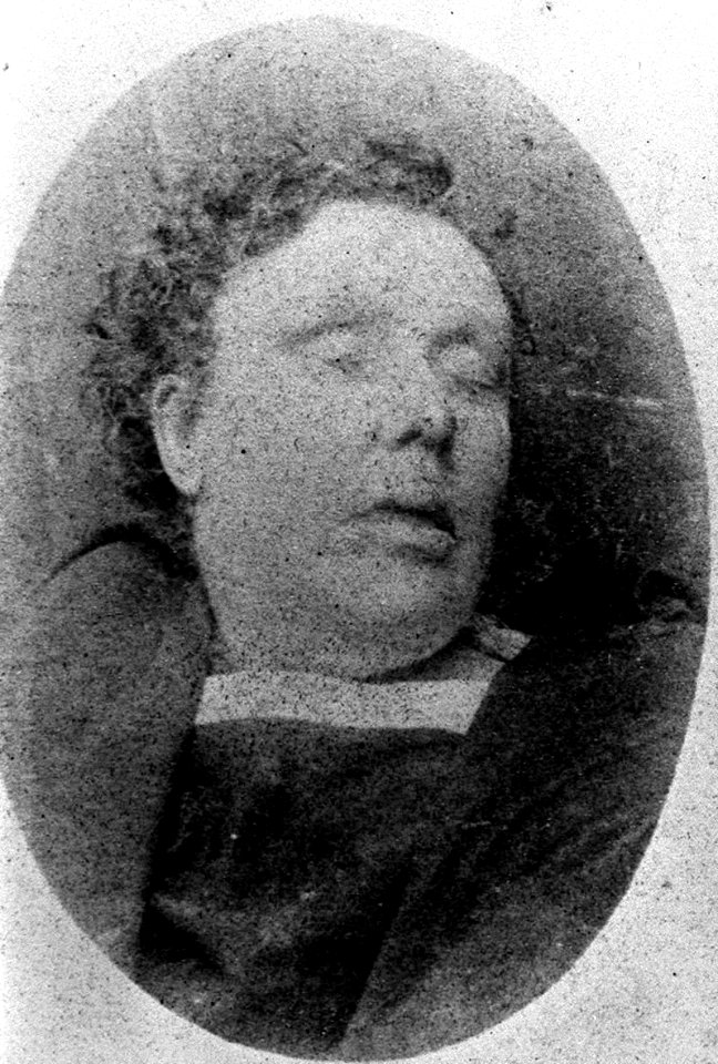 Annie Chapman mortuary photo