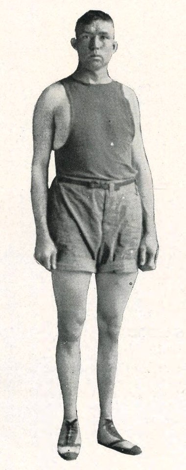 1920 Locust yearbook p. 135 (Basketball- Lemuel de Loss Parsons)