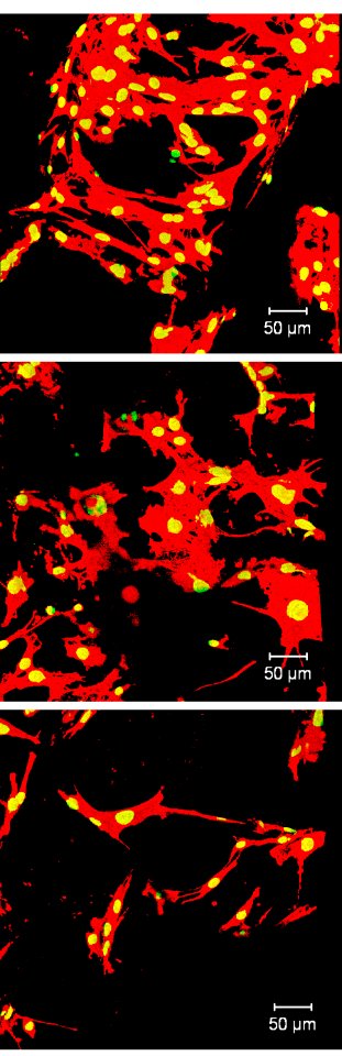3D Test Method for Biomaterials (5885545588)