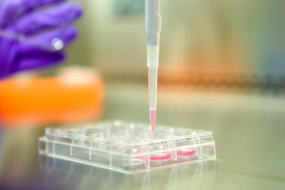 A cell culture plate with induced pluripotent stem cells (46291373491)