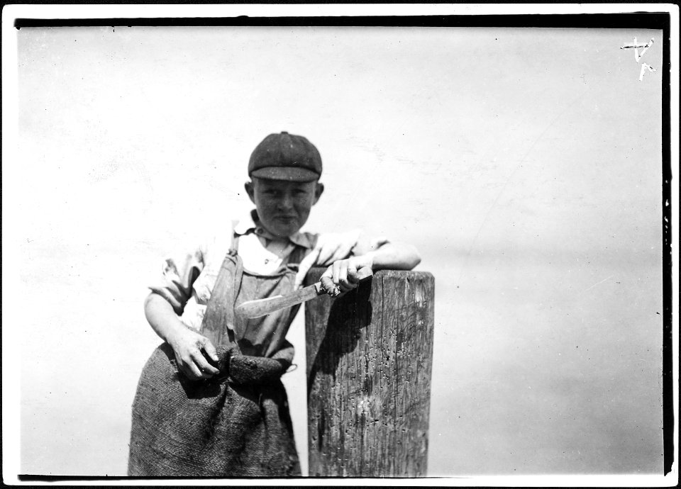 Butcher knife used by Ralph, a young cutter in a canning factory, and a badly cut finger. Several children working... - NARA - 523458