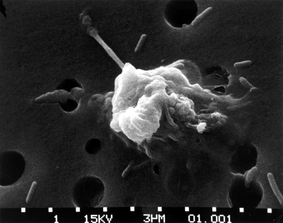 Cancer cells- death (step 6)