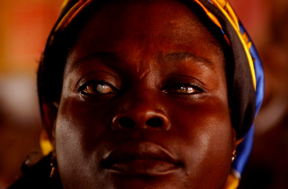 Cataracts in Ghana