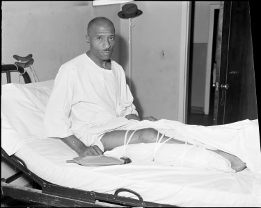 Charlie Williams who works for the Pocahontas Corporation, at the Amonate Mine, received a fractured leg in a mine... - NARA - 541104