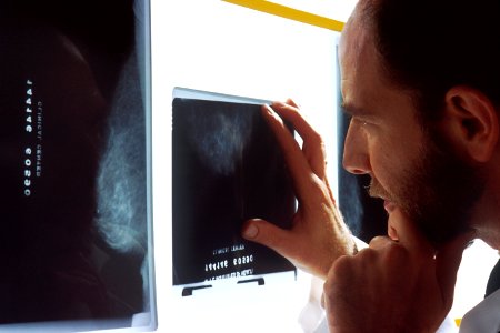 Doctor viewing mammogram