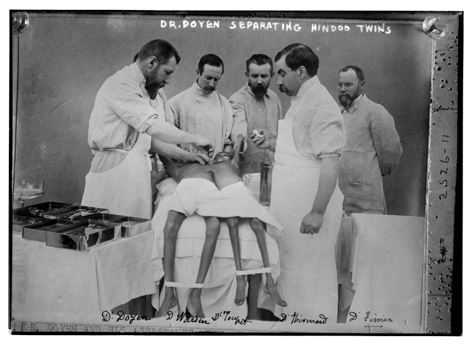 Dr. Doyen separating Hindoo twins LCCN2014691061