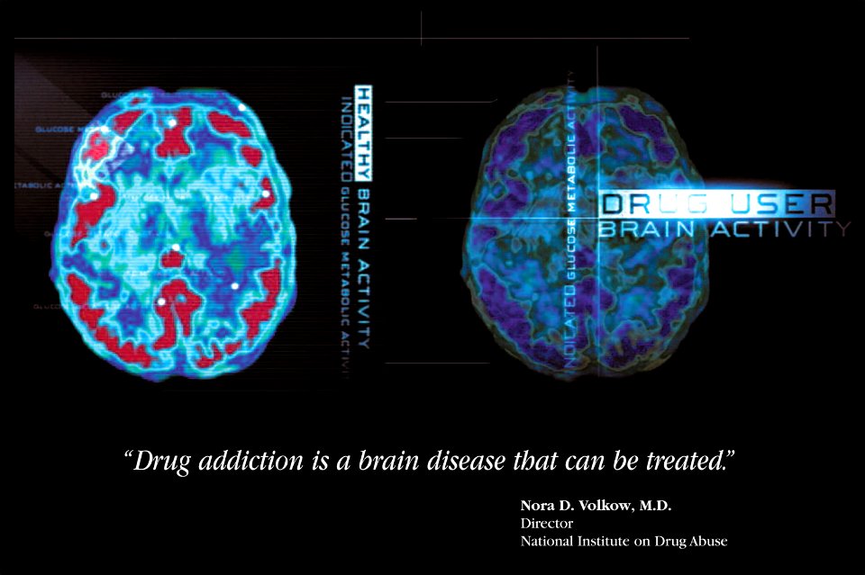 Drug Brain Activity