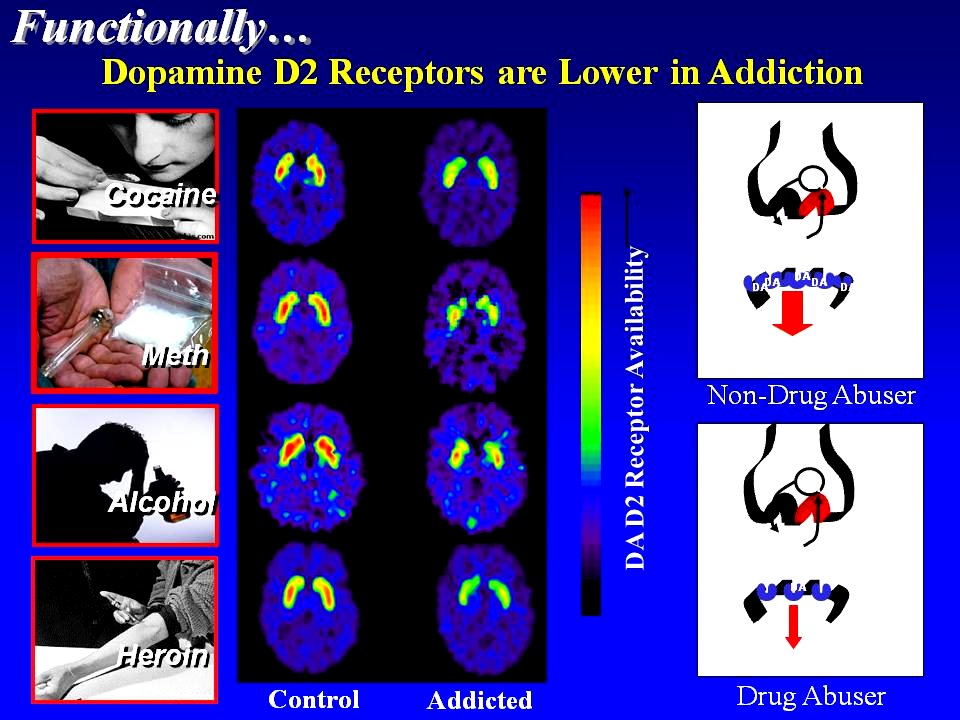 Drug Exposure Brain