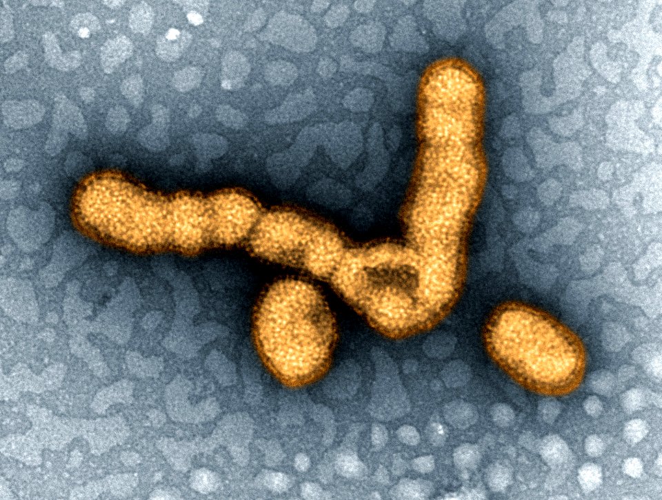 H1N1 virus particles II