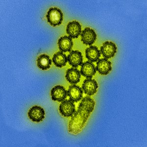 H1N1 virus particles