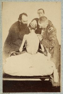 Emaciated prisoner of war from Belle Isle, Richmond, Private Isaiah G. Bowker of Co. B, 9th Maine Volunteers, at the U.S. General Hospital, Div. 1, Annapolis LCCN2013645511