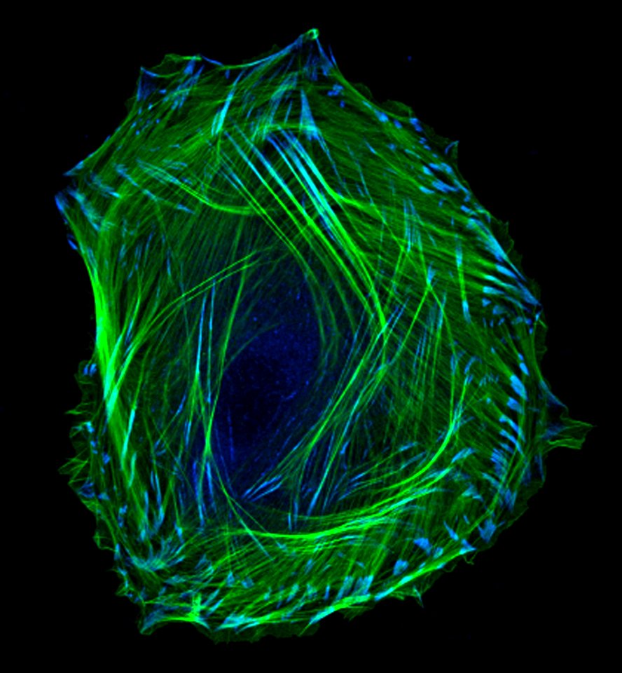Embryonic smooth muscle cell