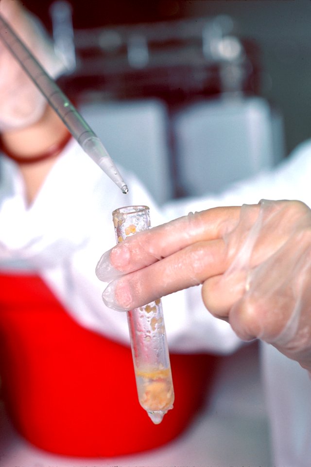 Estrogen receptor assay (4)