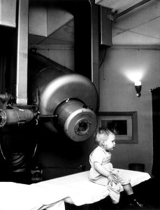 External beam radiotherapy retinoblastoma nci-vol-1924-300