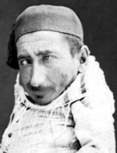 Face detail, Blind man carrying a paralysed man (cropped)