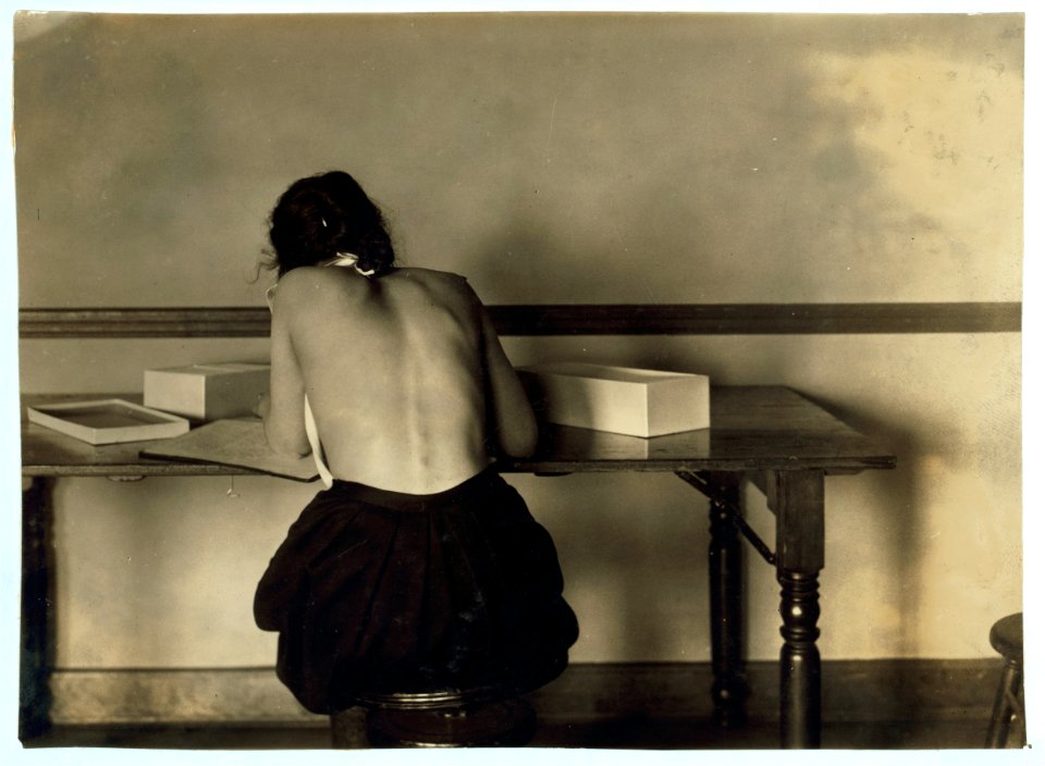 Fannie Bowman, 15 years old. Postural deformity. Correct position in work most essential. Can undertake either sitting or standing position if takes care to keep good posture. Picture shows LOC nclc.05141