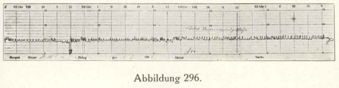 Firmenprospekt Hydro Apparate Bauanstalt 1913 Abb296