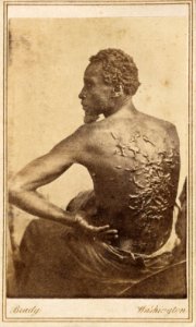 Gordon, scourged back, NPG, 1863